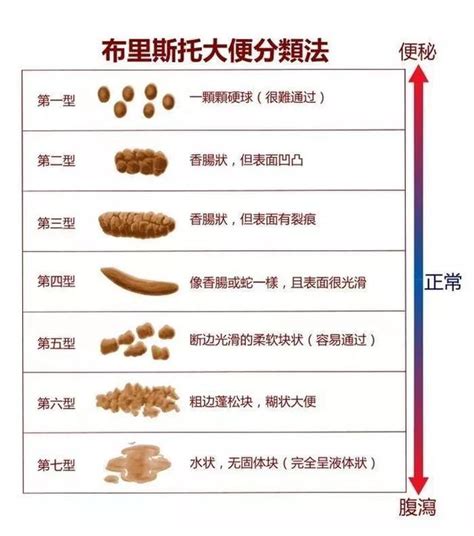 拉很多屎|几天一次大便是正常的？大便频率不是最重要的，关键是这三个指。